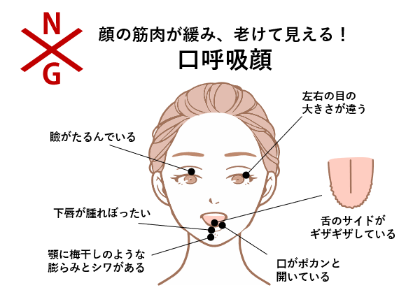 口呼吸顔