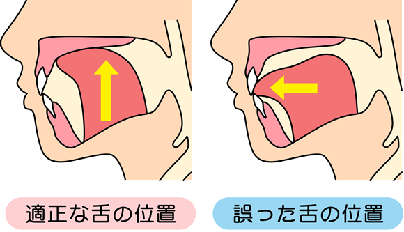 あいうべ体操の効果