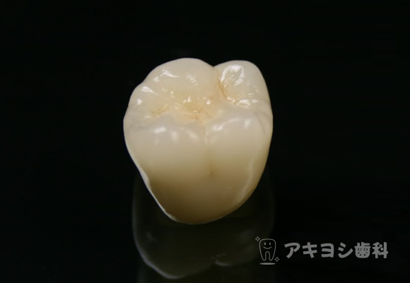 オールセラミッククラウン