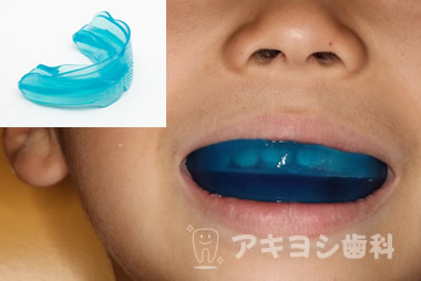 プレオルソ