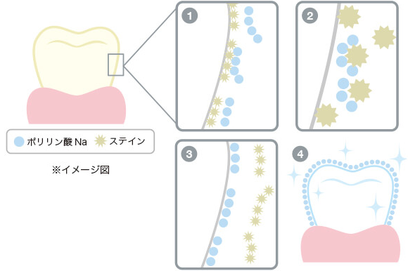 ポリリン酸ホワイトニングの仕組み