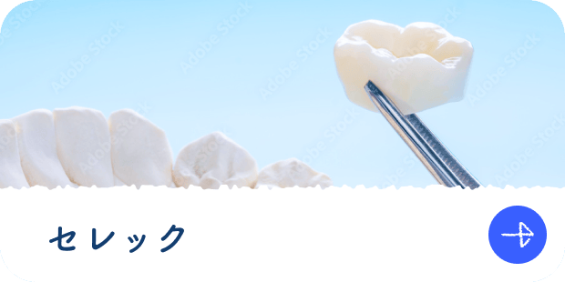 セレック